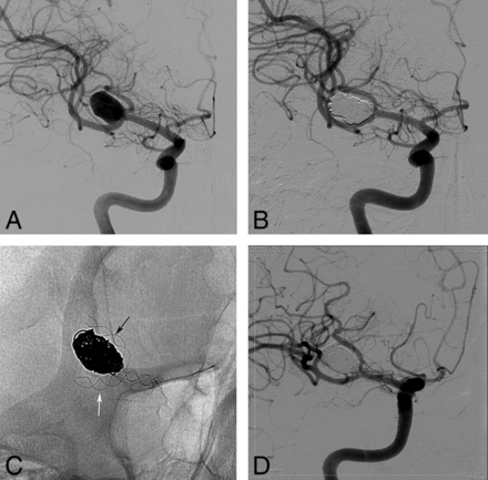 Fig 2.