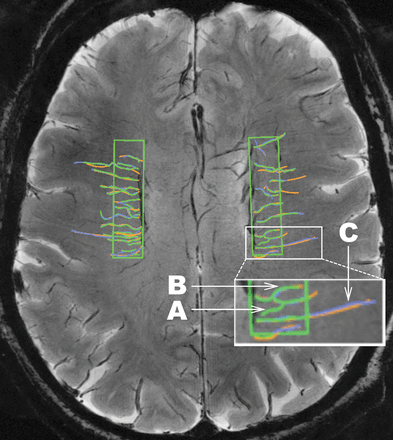 Fig 1.
