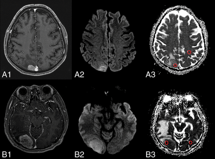 Fig 2.