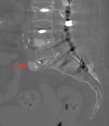 Fig 5.