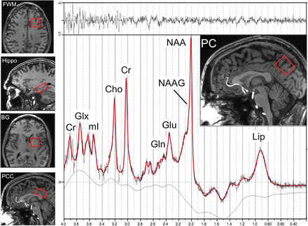 Fig 1.
