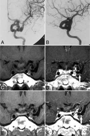Fig 3.