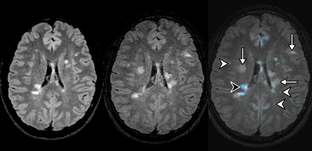Fig 2.