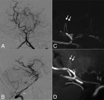 Fig 5.