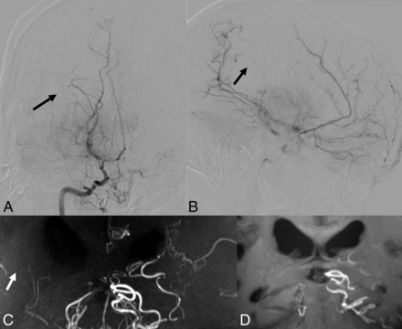 Fig 6.