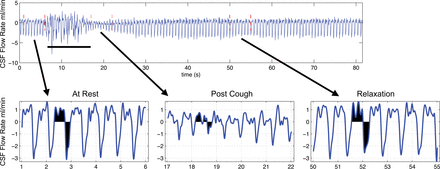 Fig 2.