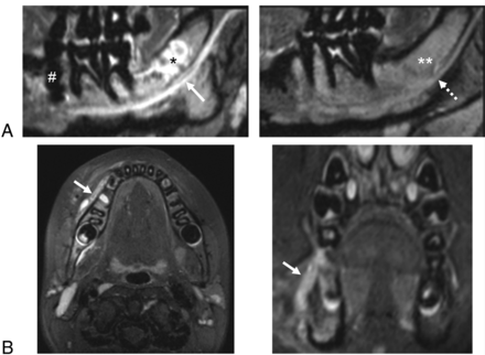 Fig 6.