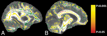 Fig 3.