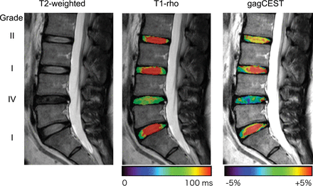 Fig 3.
