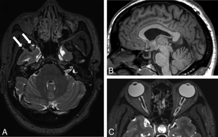 Fig 1.