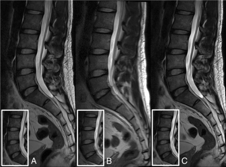 Fig 3.