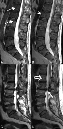 Fig 4.