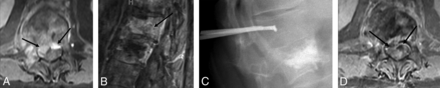 Fig 4.
