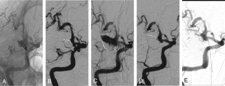 Fig 4.