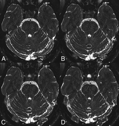 Fig 3.