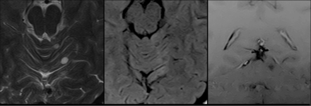 Fig 1.