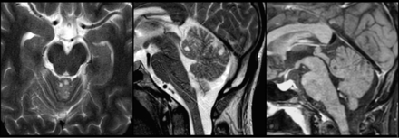 Fig 2.