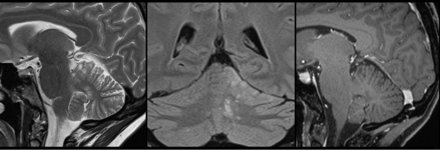 Fig 3.