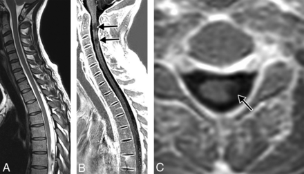 Fig 3.