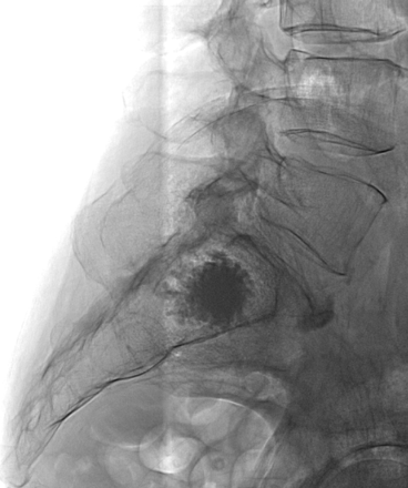 Fig 4.
