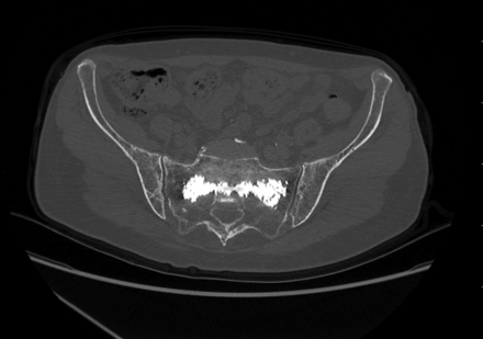 Fig 6.