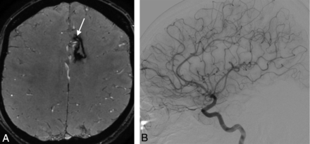 Fig 6.