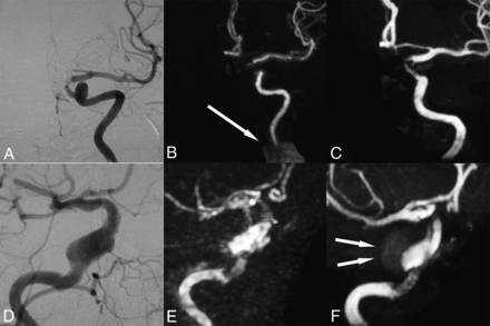 Fig 4.