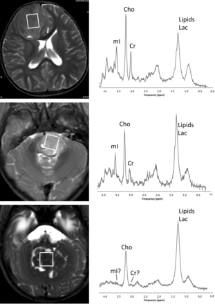 Fig 1.