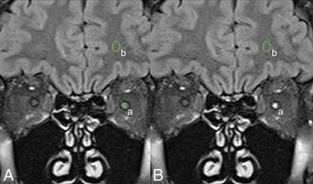 Fig 1.