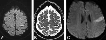 Fig 3.