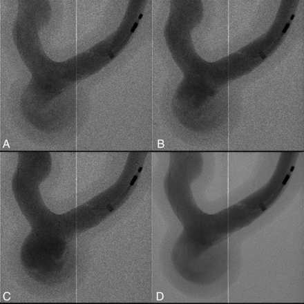 Fig 2.