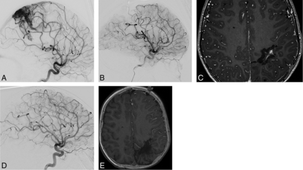 Fig 3.