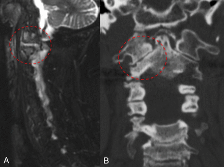 Fig 1.