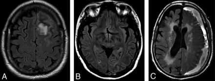 Fig 2.