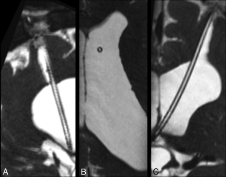 Fig 1.