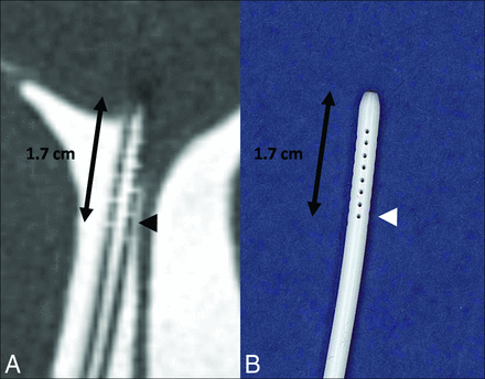 Fig 2.