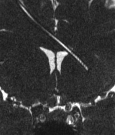 Fig 3.