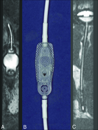 Fig 6.