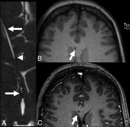 Fig 7.