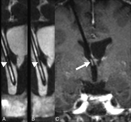 Fig 8.