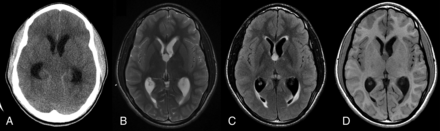 FIG 3.
