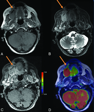 FIG 1.