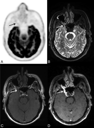 FIG 2.