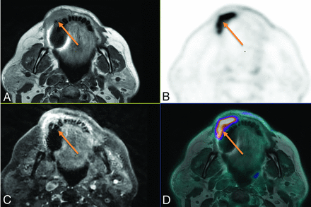 FIG 3.