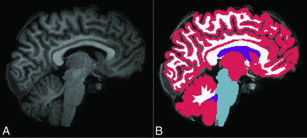 FIG 2.