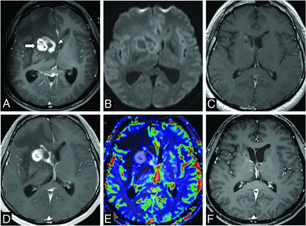 FIG 3.