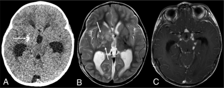 FIG 3.