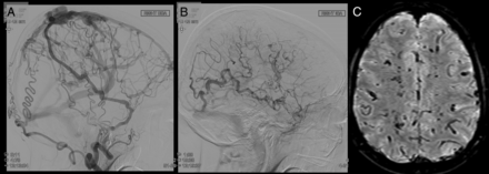 FIG 1.