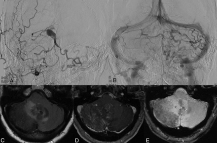 FIG 3.