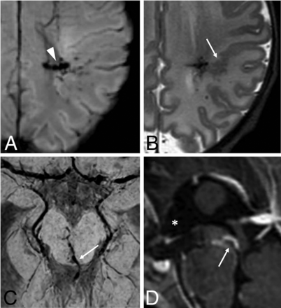 FIG 3.
